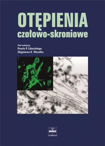 Otępienia czołowo-skroniowe