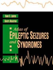 Atlas of Epileptic Seizures and Syndromes